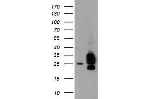 HEK293T cells were transfected with the pCMV6-ENTRY control (Left lane) or pCMV6-ENTRY CLPP (Right lane) cDNA for 48 hrs and lysed. (CLPP antibody)