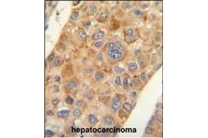 Immunohistochemistry (Paraffin-embedded Sections) (IHC (p)) image for anti-alpha-Methylacyl-CoA Racemase (AMACR) (AA 323-351), (C-Term) antibody (ABIN654069)
