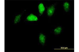 Immunofluorescence of purified MaxPab antibody to GNL1 on HeLa cell. (GNL1 antibody  (AA 1-607))