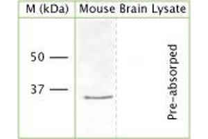 WB on mouse brain lysate (denatured, reduced) using Rabbit antibody to n-terminal region of OLIG2 (Oligo2, bHLHB1, RACK17): IgG (ABIN350657) at a concentration of 30 µg/ml. (OLIG2 antibody  (AA 80-130))