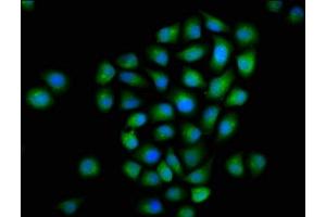 Immunofluorescence staining of Hela cells with ABIN7160643 at 1:133, counter-stained with DAPI. (MTMR2 antibody  (AA 1-173))
