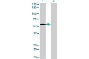 Western Blot analysis of ZNF622 expression in transfected 293T cell line by ZNF622 monoclonal antibody (M02), clone 3C5. (ZNF622 antibody  (AA 1-100))