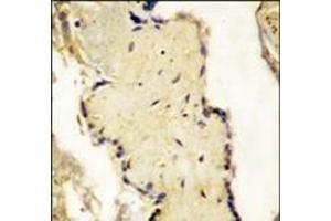 Formalin-fixed and paraffin-embedded placenta tissue reacted with SPPL2a Antibody (N-term), which was peroxidase-conjugated to the secondary antibody, followed by DAB staining. (SPPL2A antibody  (N-Term))