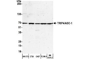 Western Blotting (WB) image for anti-Thyroid Hormone Receptor Interactor 4 (TRIP4) (AA 225-275) antibody (ABIN7450846) (TRIP4 antibody  (AA 225-275))