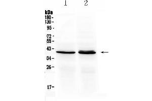 Western blot analysis of OTC using anti- OTC antibody . (OTC antibody  (N-Term))
