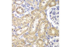 Immunohistochemistry of paraffin-embedded rat liver using HADH antibody at dilution of 1:100 (400x lens). (HADH antibody)
