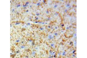Used in DAB staining on fromalin fixed paraffin-embedded Brain tissue (MBP antibody  (AA 220-301))