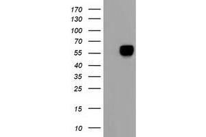 HEK293T cells were transfected with the pCMV6-ENTRY control (Left lane) or pCMV6-ENTRY AFP (Right lane) cDNA for 48 hrs and lysed. (alpha Fetoprotein antibody)