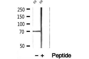 Western blot analysis of extracts of A549 cells, using LGALS3BP antibody. (LGALS3BP antibody  (C-Term))