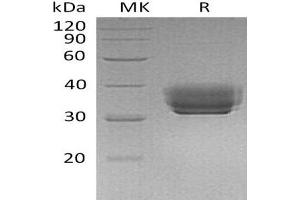 Western Blotting (WB) image for Butyrophilin, Subfamily 1, Member A1 (BTN1A1) protein (His tag) (ABIN7320474) (BTN1A1 Protein (His tag))