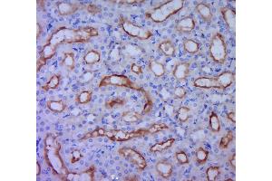 Paraformaldehyde-fixed, paraffin embedded rat kidney, Antigen retrieval by boiling in sodium citrate buffer (pH6. (UGT1A9 antibody  (AA 101-200))