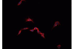 ABIN6268855 staining 293T  cells by IF/ICC. (CysLTR1 antibody)