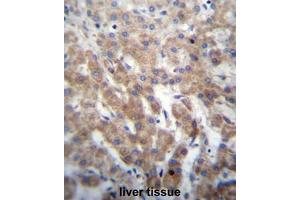FGFRL1 Antibody (N-term) immunohistochemistry analysis in formalin fixed and paraffin embedded human liver tissue followed by peroxidase conjugation of the secondary antibody and DAB staining. (FGFRL1 antibody  (N-Term))