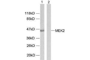Western blot analysis of extracts from ovary cancer cells using MEK2 (Ab-394) antibody (E021008). (MEK2 antibody)