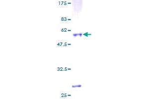 IGFBP4 Protein (AA 1-258) (GST tag)