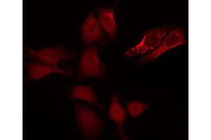 ABIN6267651 staining Hela by IF/ICC. (Caspase 8 antibody  (pSer347))
