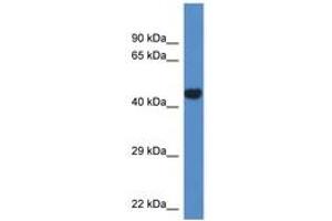 Image no. 1 for anti-Phosphate Cytidylyltransferase 2, Ethanolamine (PCYT2) (AA 109-158) antibody (ABIN6746367) (PCYT2 antibody  (AA 109-158))