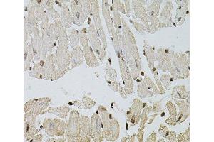 Immunohistochemistry of paraffin-embedded Mouse heart using FGF2 Polyclonal Antibody at dilution of 1:100 (40x lens). (FGF2 antibody)