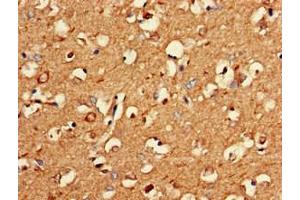 Immunohistochemistry of paraffin-embedded human brain tissue using ABIN7162627 at dilution of 1:100 (PNMA2 antibody  (AA 2-361))