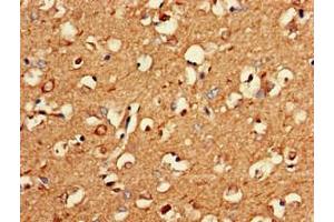 Immunohistochemistry of paraffin-embedded human brain tissue using ABIN7162627 at dilution of 1:100