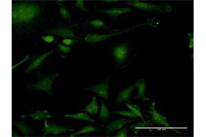 Immunofluorescence of purified MaxPab antibody to PPIL2 on HeLa cell.