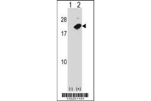 Western blot analysis of NUDT2 using rabbit polyclonal NUDT2 Antibody using 293 cell lysates (2 ug/lane) either nontransfected (Lane 1) or transiently transfected (Lane 2) with the NUDT2 gene. (NUDT2 antibody  (AA 62-90))