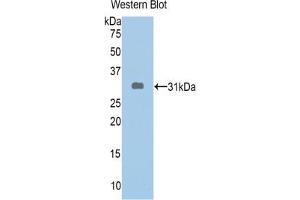 Western blot analysis of the recombinant protein. (ABCA1 antibody  (AA 1404-1663))