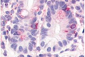 Immunohistochemical staining of human small intestine with HNF4G polyclonal antibody . (HNF4 gamma antibody  (Internal Region))