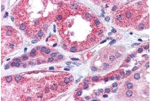 Kidney, Human: Formalin-Fixed, Paraffin-Embedded (FFPE) (IGSF8 antibody  (Internal Region))
