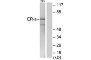 Western blot analysis of extracts from 293 cells, using Estrogen Receptor-alpha (Ab-537) Antibody.