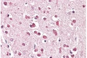 Image no. 1 for anti-XPA Binding Protein 2 (XAB2) (C-Term) antibody (ABIN374084) (XAB2 antibody  (C-Term))