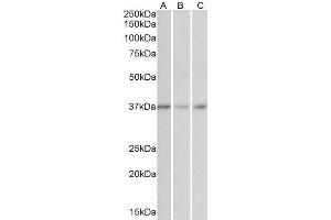 ABIN571105 (0. (GHITM antibody  (Internal Region))