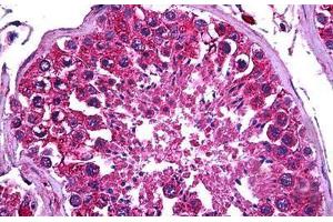 Human Testis: Formalin-Fixed, Paraffin-Embedded (FFPE) (PDK2 antibody  (AA 187-276))