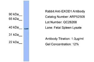 WB Suggested Anti-EXOD1  Antibody Titration: 0. (ERI2 antibody  (N-Term))