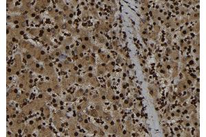 ABIN6263929 and ABIN6273282 at 1/100 staining Human liver tissue by IHC-P.