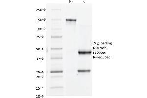 SDS-PAGE Analysis Purified CD61 Monoclonal Antibody (Y2/51). (Integrin beta 3 antibody)