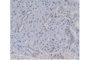 IHC-P analysis of Rat Kidney Tissue, with DAB staining. (Prothrombin antibody  (AA 201-323))