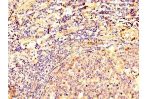 IHC image of ABIN7149787 diluted at 1:500 and staining in paraffin-embedded human tonsil tissue performed on a Leica BondTM system. (Desmoglein 3 antibody  (AA 70-615))