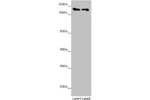 Western blot All lanes: DDX11 antibody at 8. (DDX11 antibody  (AA 1-220))