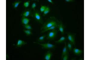 Immunofluorescence staining of Hela cells with ABIN7157599 at 1:200, counter-stained with DAPI. (KIF15 antibody  (AA 1-129))