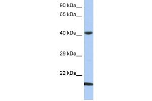 WB Suggested Anti-SEC14L4 Antibody Titration: 0. (SEC14L4 antibody  (N-Term))