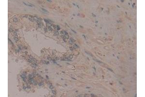 Detection of Flt3 in Human Prostate Tissue using Polyclonal Antibody to FMS Like Tyrosine Kinase 3 (Flt3) (FLT3 antibody  (AA 334-543))