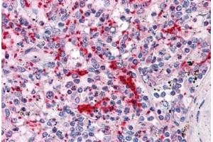 Human Spleen: Formalin-Fixed, Paraffin-Embedded (FFPE) (TLN1 antibody  (AA 1052-1150))