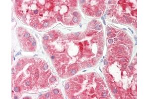 Human Kidney: Formalin-Fixed, Paraffin-Embedded (FFPE). (TCF25 antibody  (AA 182-231))