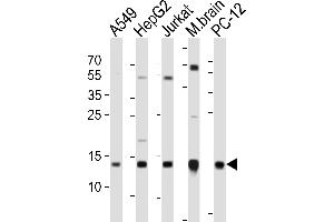 Western blot analysis of lysates from A549, HepG2, Jurkat cell line, mouse brain tissue lysate, rat PC-12 cell line (from left to right), using ATP5D Antibody (C-term) (ABIN6242954 and ABIN6577658). (ATP5F1D antibody  (C-Term))