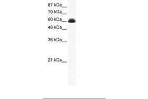 Image no. 1 for anti-DEAD (Asp-Glu-Ala-Asp) Box Polypeptide 27 (DDX27) (AA 118-167) antibody (ABIN202920) (DDX27 antibody  (AA 118-167))