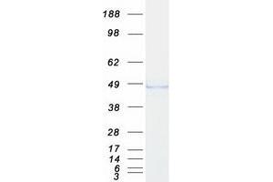 Western Blotting (WB) image for Adhesion Regulating Molecule 1 (Adrm1) (Transcript Variant 1) protein (Myc-DYKDDDDK Tag) (ABIN2714437)