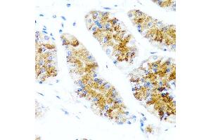 Immunohistochemistry of paraffin-embedded human stomach using SIRT1 antibody at dilution of 1:100 (40x lens).