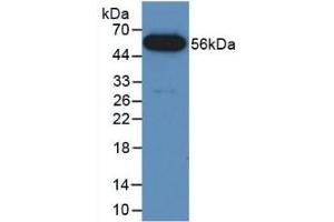 Detection of Recombinant FUS, Mouse using Polyclonal Antibody to Fusion (FUS) (Fusion (FUS) (AA 3-267) antibody)