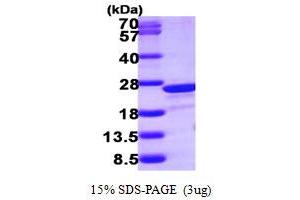 SDS-PAGE (SDS) image for Transgelin 2 (TAGLN2) (AA 13-199) protein (His tag) (ABIN5779993)